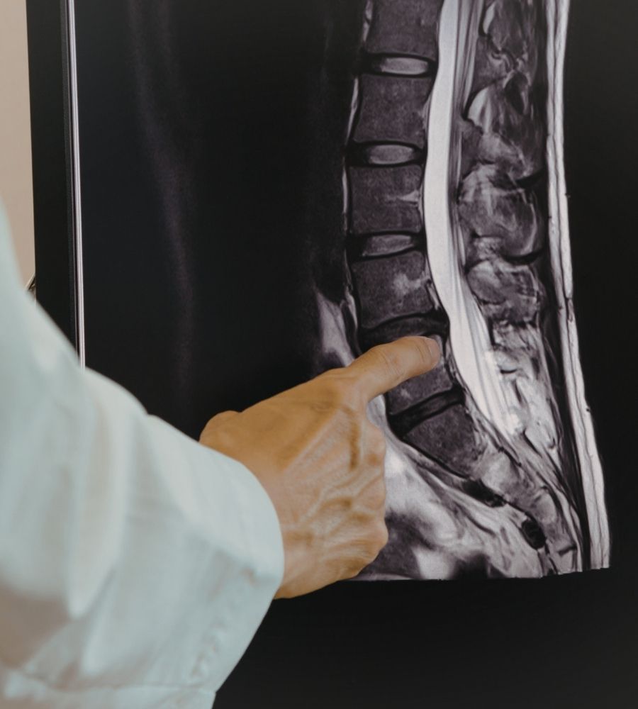 Spinal surgery