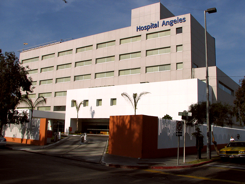 hospital angeles tijuana
