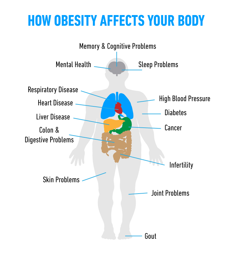Image result for Effect of obesity