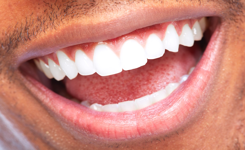 Smile.