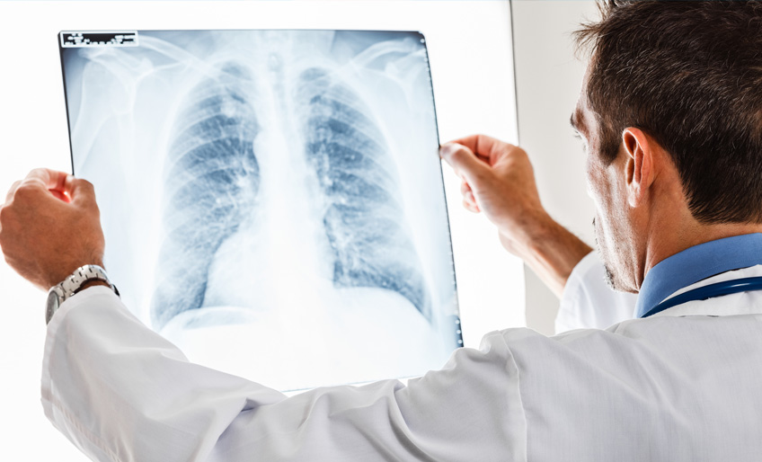 stemcell_copd