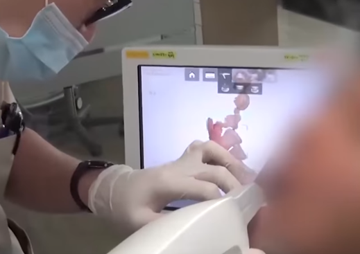 oral scan DIO